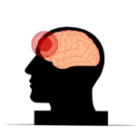 美研究：COVID-19 染疫者腦損風險上升