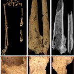 科学家发现3.1万年前骨骼 为最早截肢手术证据
