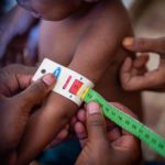 联合国：西非3国今年恐近百万幼童严重营养不良